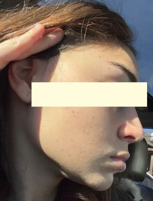 Naturopathic and holistic acne doctor Dr. Sheyda Vadipour helps you heal your acne naturally and achieve clear skin through functional lab testing, hormone and gut healing, and root-cause medicine.