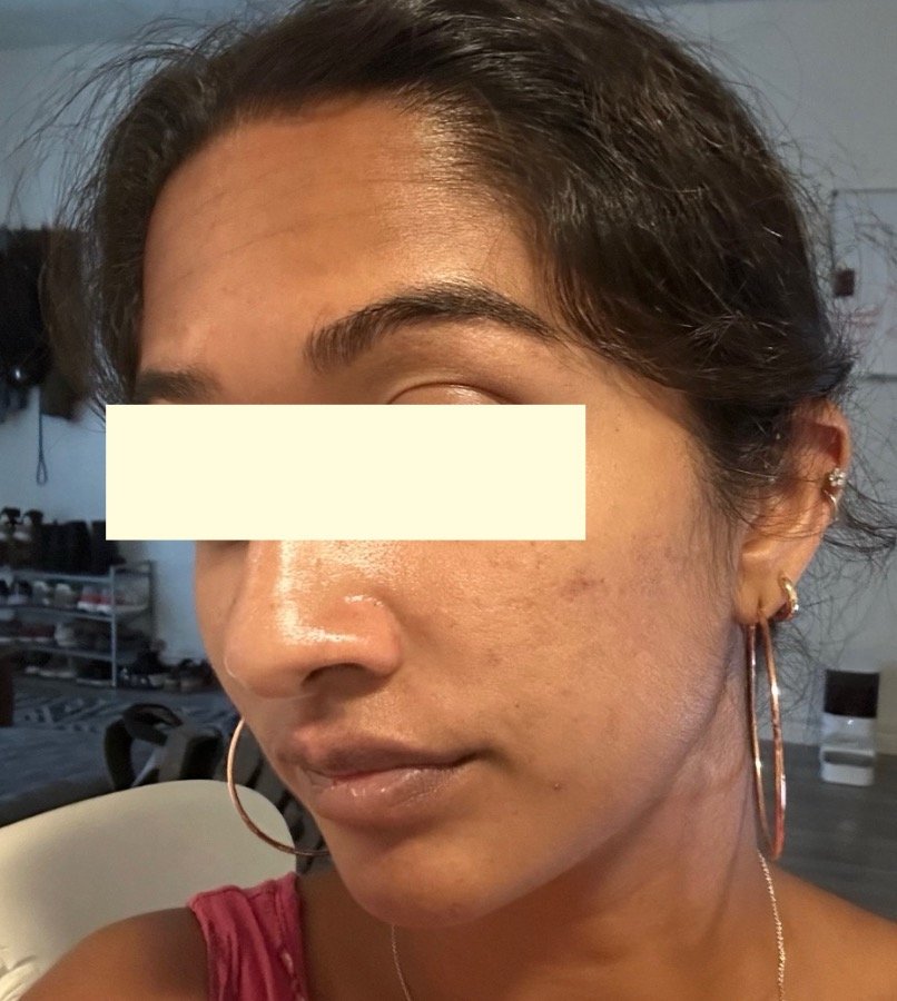 Naturopathic and holistic acne doctor Dr. Sheyda Vadipour helps you heal your acne naturally and achieve clear skin through functional lab testing, hormone and gut healing, and root-cause medicine.
