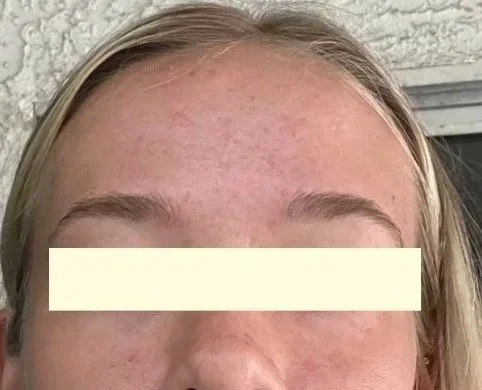 Naturopathic and holistic acne doctor Dr. Sheyda Vadipour helps you heal your acne naturally and achieve clear skin through functional lab testing, hormone and gut healing, and root-cause medicine.