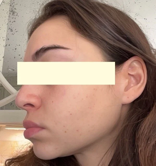 Naturopathic and holistic acne doctor Dr. Sheyda Vadipour helps you heal your acne naturally and achieve clear skin through functional lab testing, hormone and gut healing, and root-cause medicine.