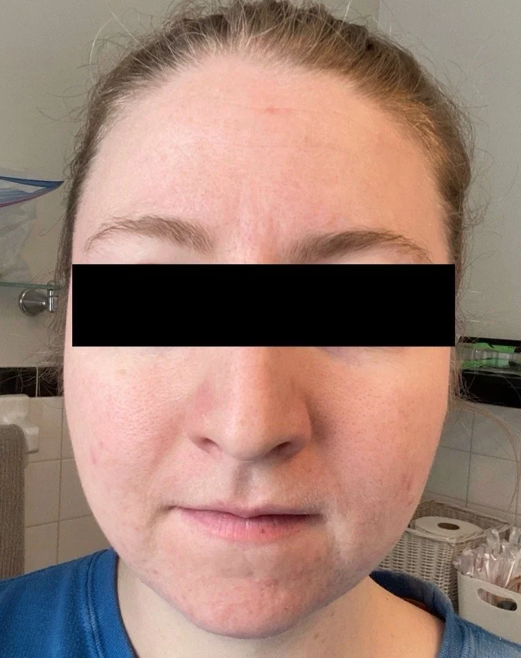 Naturopathic and holistic acne doctor, Dr. Sheyda Vadipour, helping you heal acne naturally and achieve clear skin through functional lab testing, hormone and gut healing, and root-cause medicine.