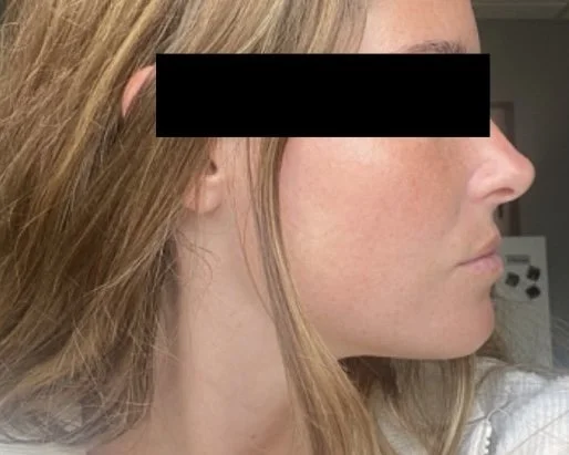 Naturopathic and holistic acne doctor Dr. Sheyda Vadipour helps you achieve lasting clear skin through functional lab testing, hormone and gut healing, and root-cause medicine.