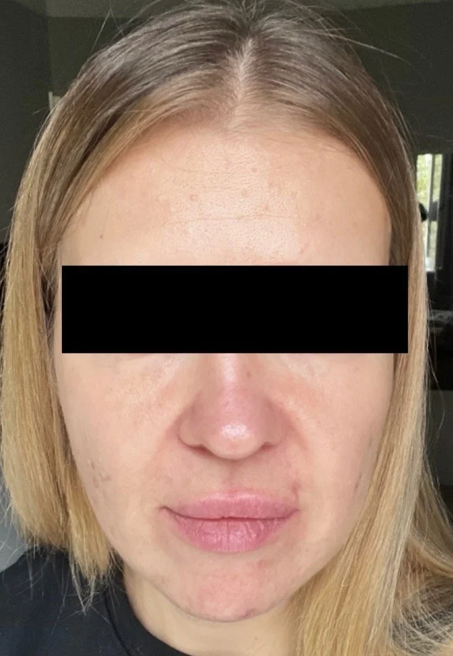 Naturopathic and holistic acne doctor Dr. Sheyda Vadipour helps you achieve lasting clear skin through functional lab testing, hormone and gut healing, and root-cause medicine.