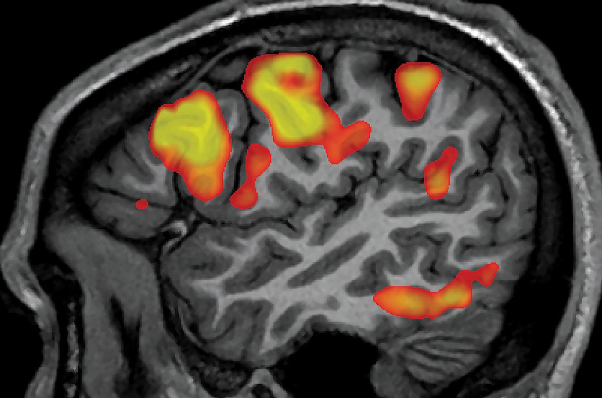 Science In Silico: Medical Imaging, AI & High Performance Computing.