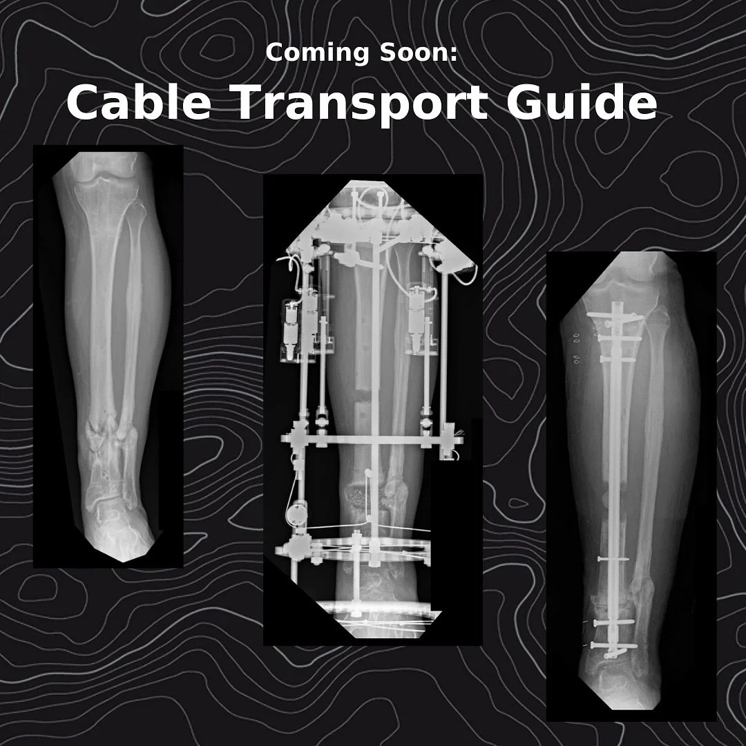 Publishing a Cable Transport Guide. DM if you want on the short list 

#bonetransport #bonedefects #limblengthening #gratitude #rehabilitation #newbeginnings #orthopaedics #bone #limbdifference #savealife #savealimb #deformity #reach #bone #limbdiffe