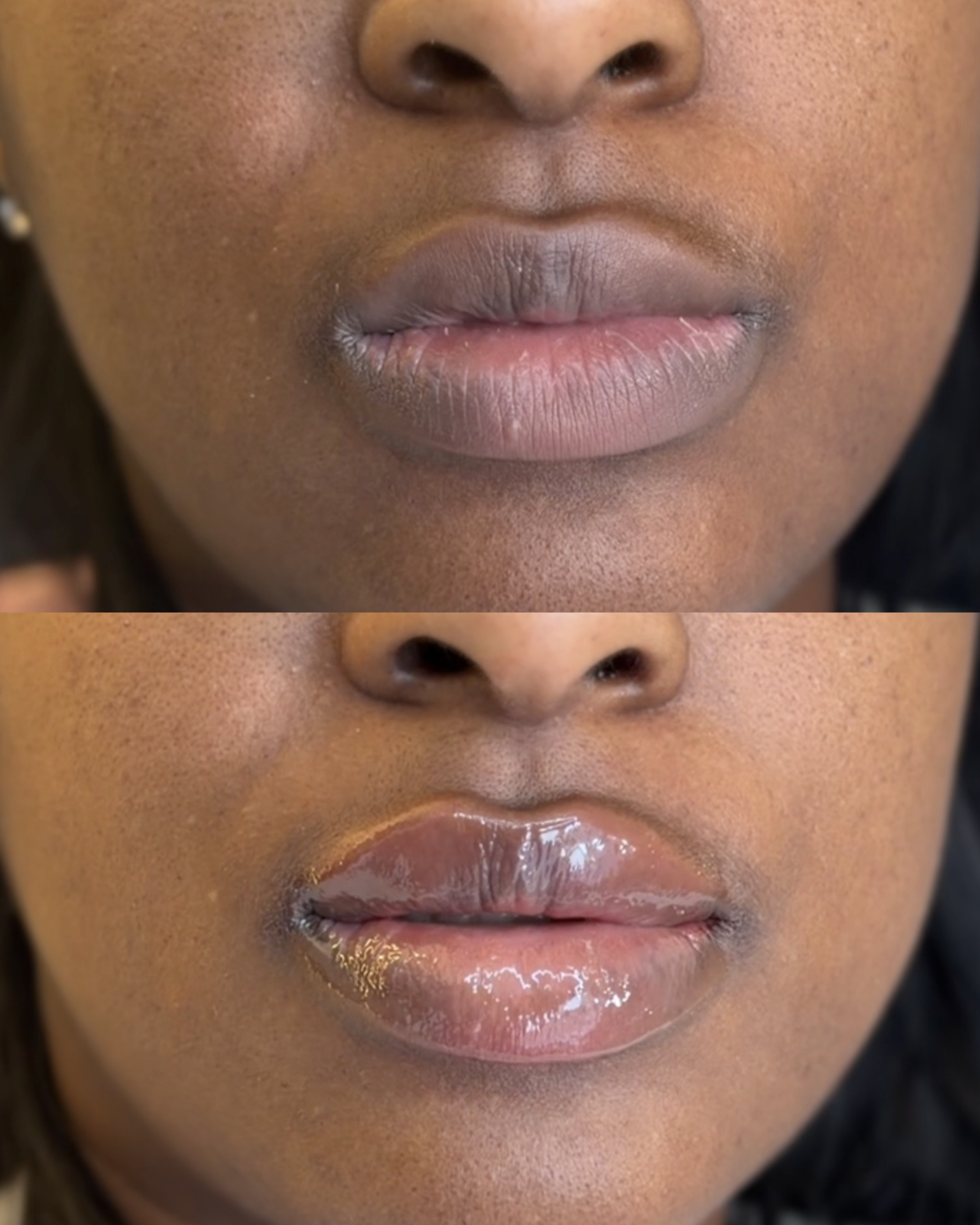 Close-up of a person's face showing their nose, lips, and chin in three different views.