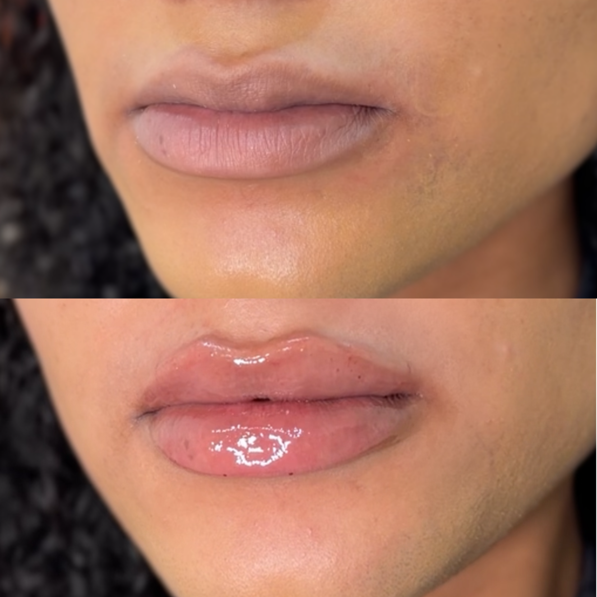Close-up of a person's lips with glossy pink lipstick, showing the lower half of the face including the chin and surrounding skin.