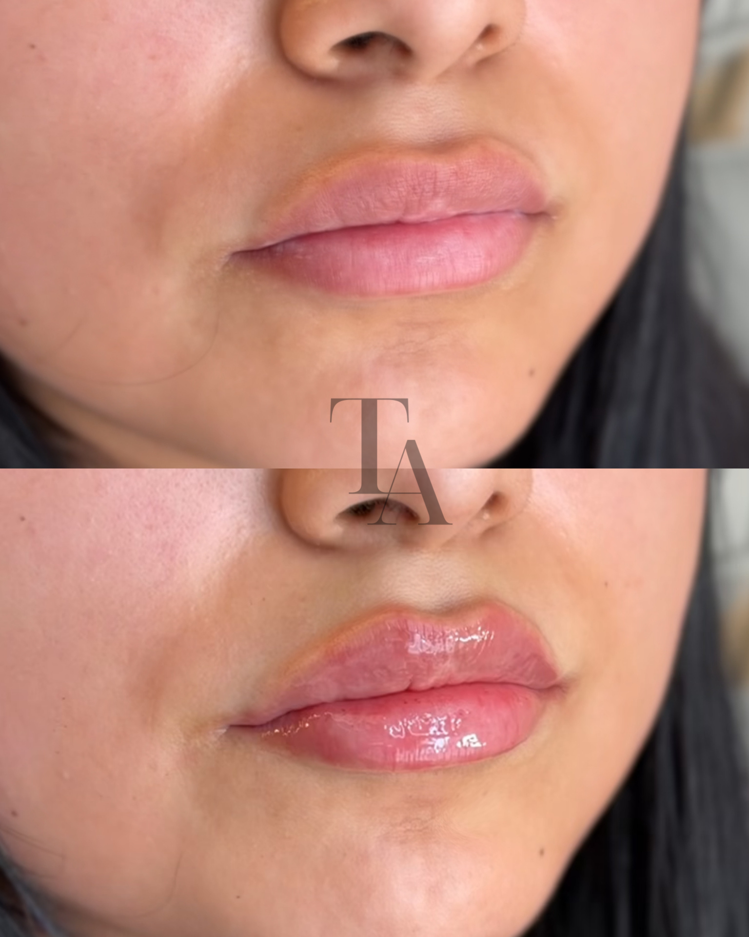 Close-up of a person's face showing their nose, lips, and part of their cheek and chin, with smooth skin and natural makeup.
