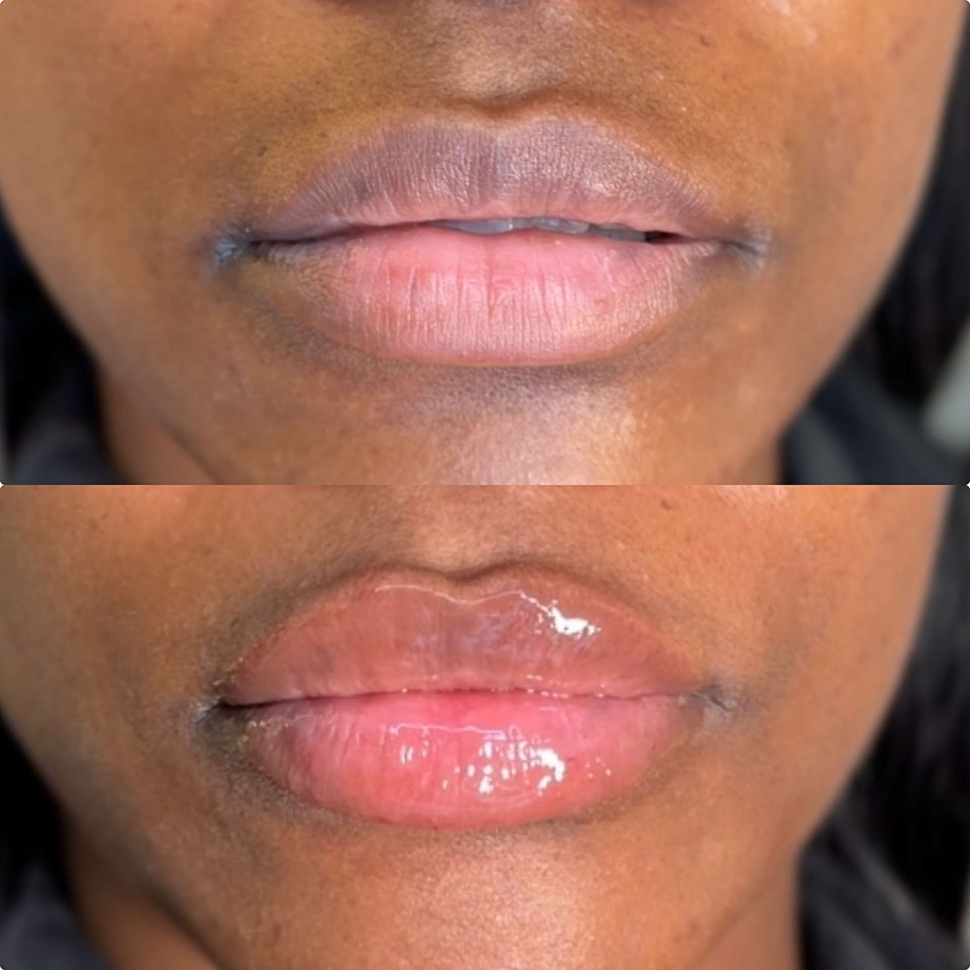 Close-up of person's lips with glossy pink lipstick and smooth skin around the mouth.