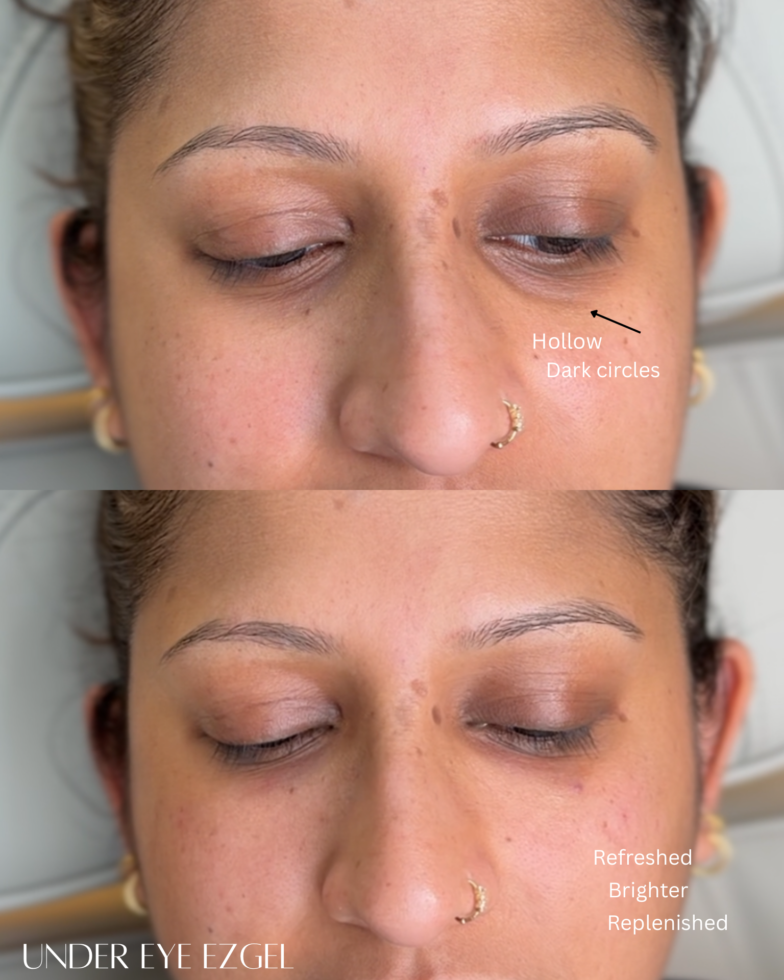 Close-up of a woman's face showing her eye area before and after applying an under-eye gel, with labeled differences including 'Hollow,' 'Dark circles,' 'Refreshed,' 'Brighter,' and 'Replenished.'