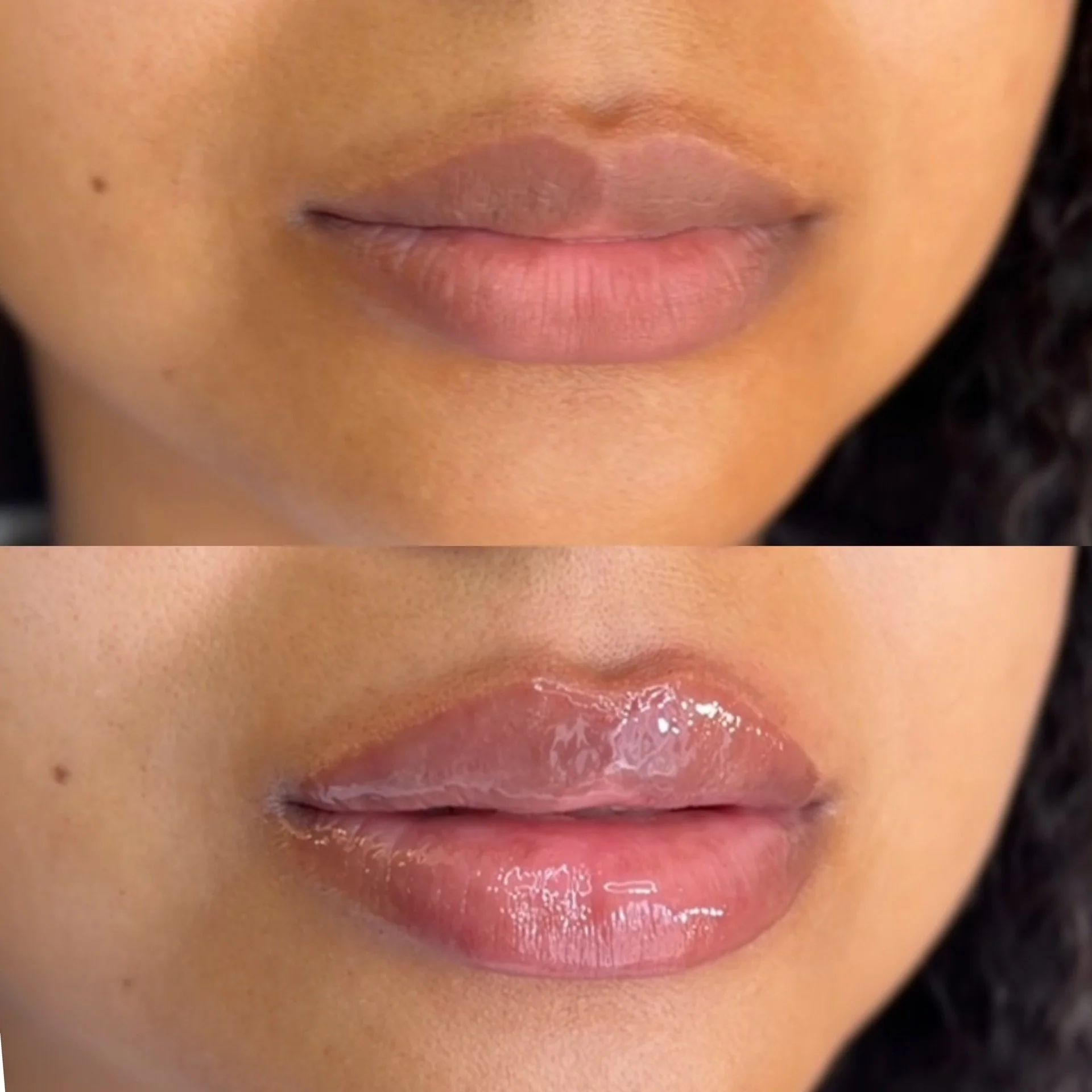 Close-up of lips with pink lipstick and shiny gloss, partly open, showing a small portion of teeth. Skin around the lips and a mole on the face are visible.