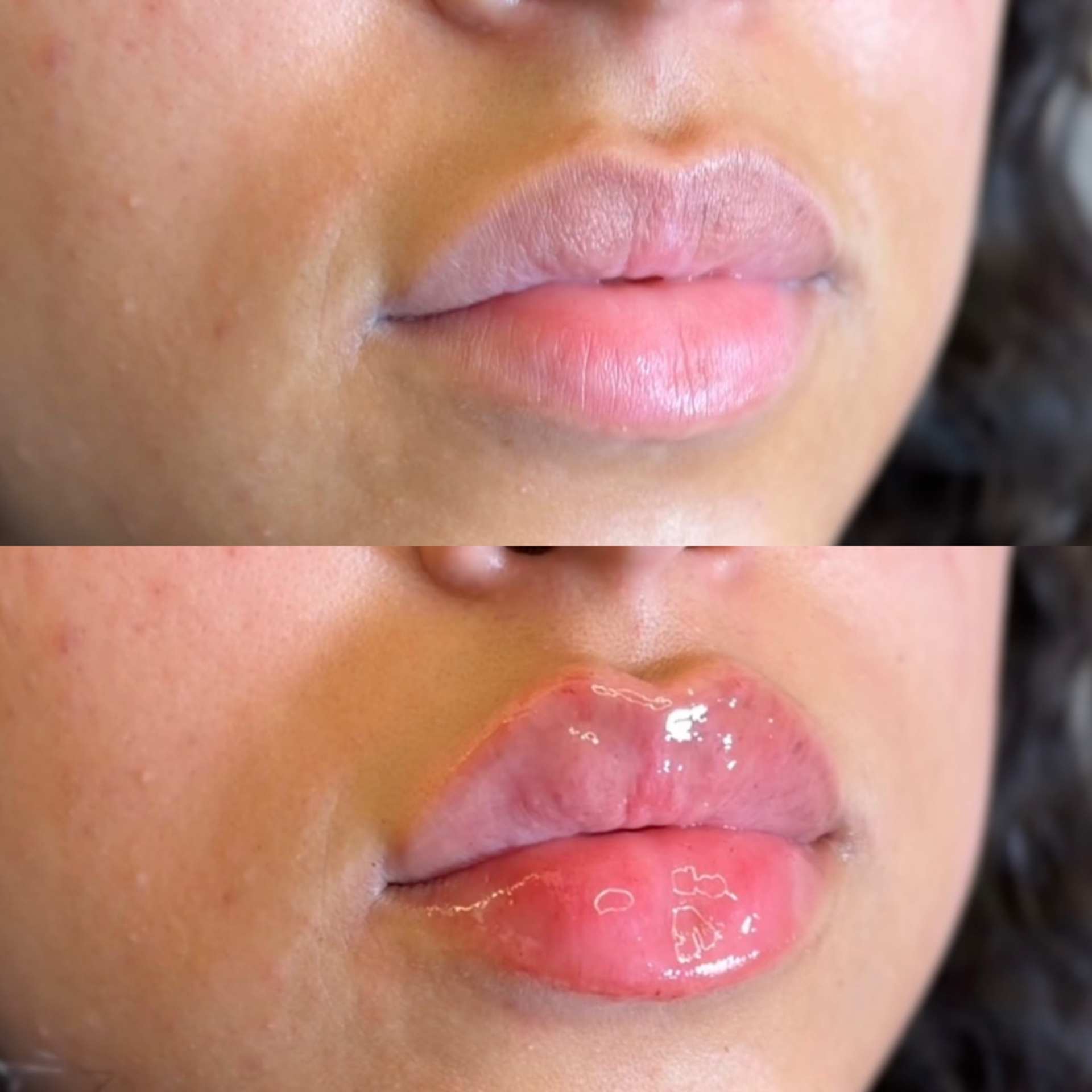 Close-up of a person's lips and part of the face, with glossy pink lips and smooth skin.