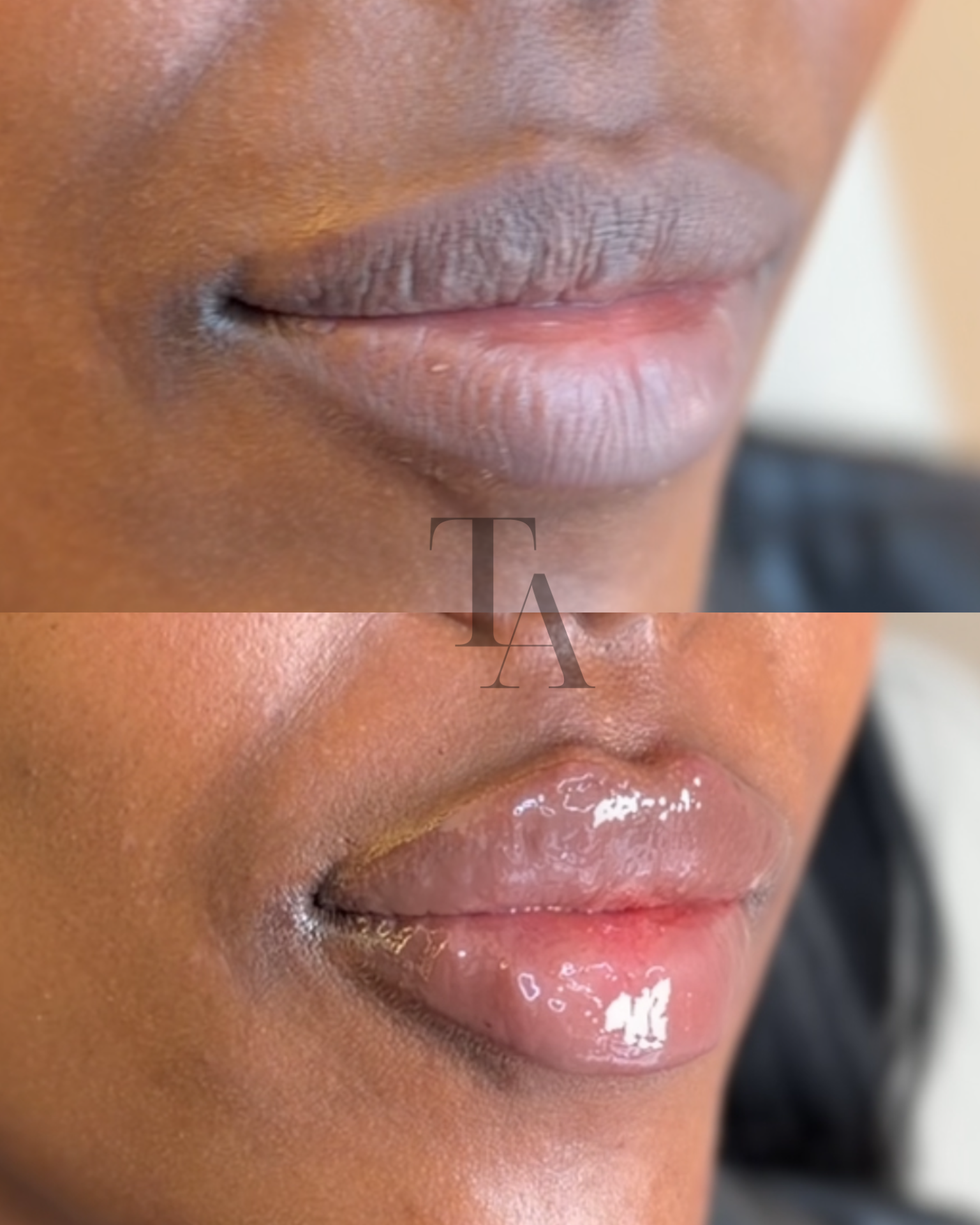 Close-up of a person's lips with shiny, slightly parted lips and smooth skin, showing skin tone and texture.