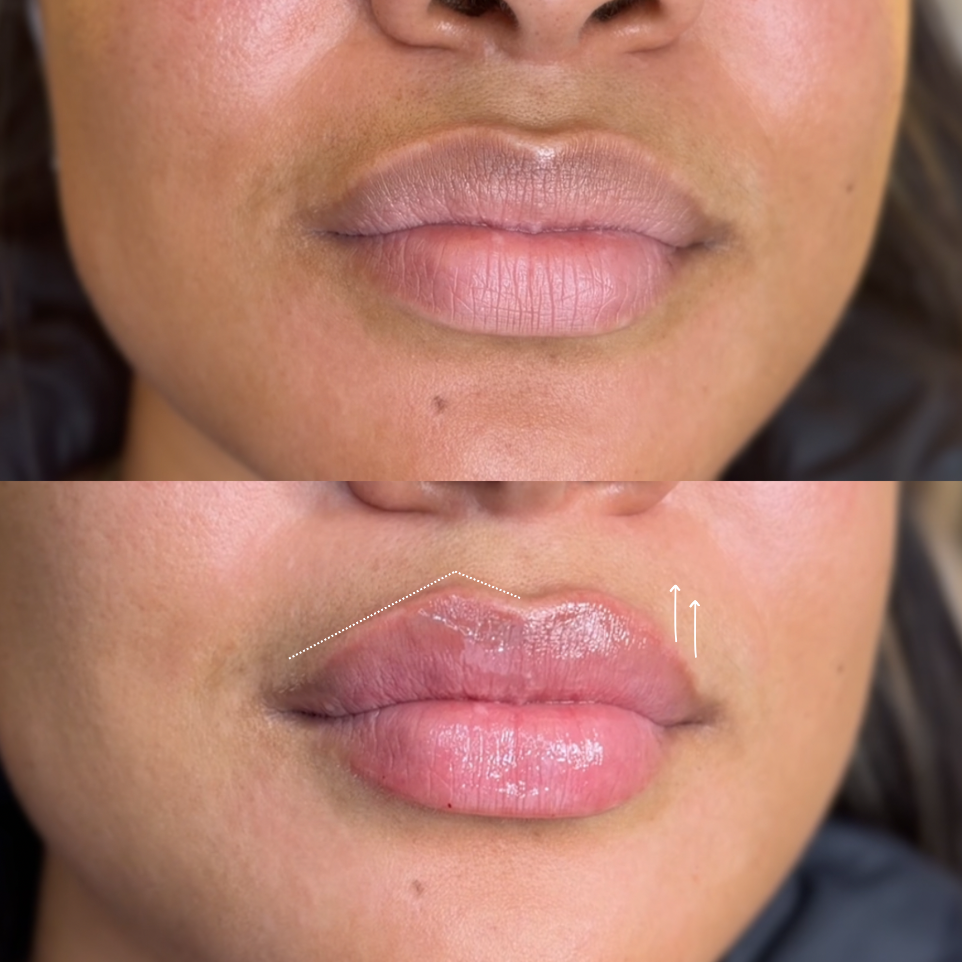 Close-up of a person's lips, showing a natural pink color and glossy finish.