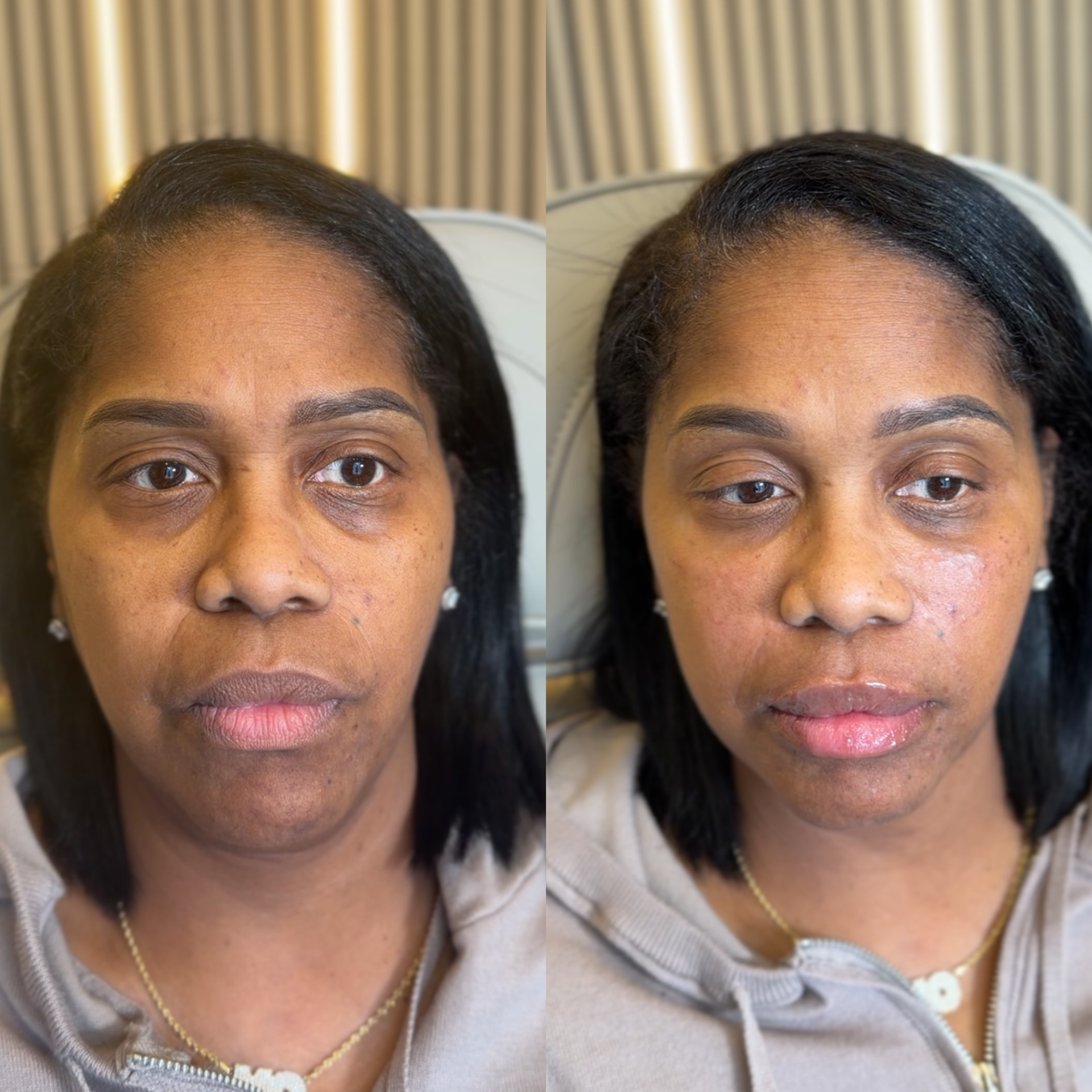 Close-up of a woman's face showing before and after photos of her hair transformation, highlighting hair growth and styling differences.