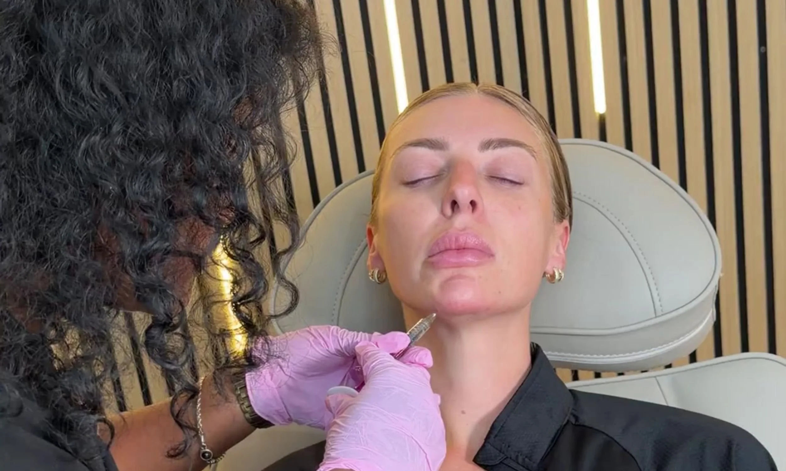 Dermal Fillers