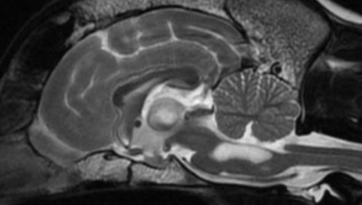 lat brain.png