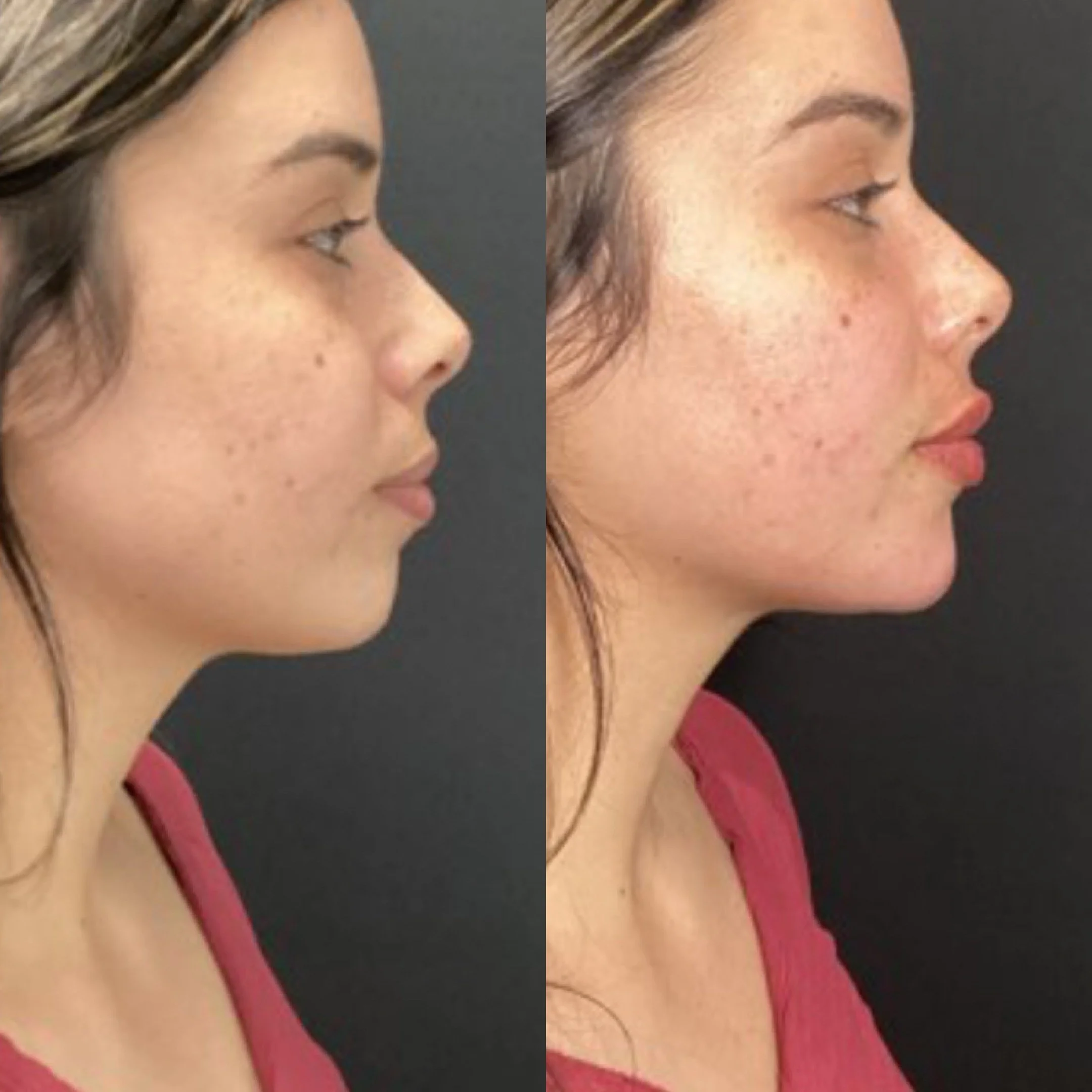 Before / After