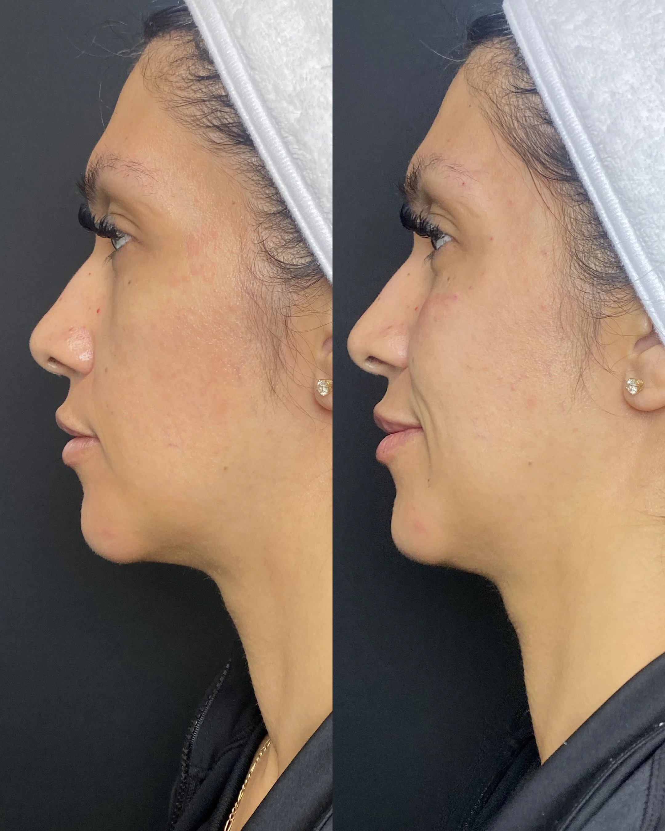 Before / After