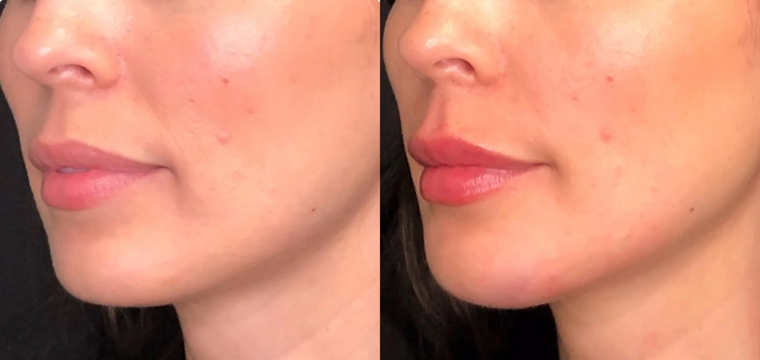Before / After