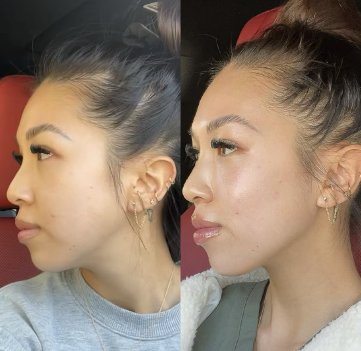 Before / After