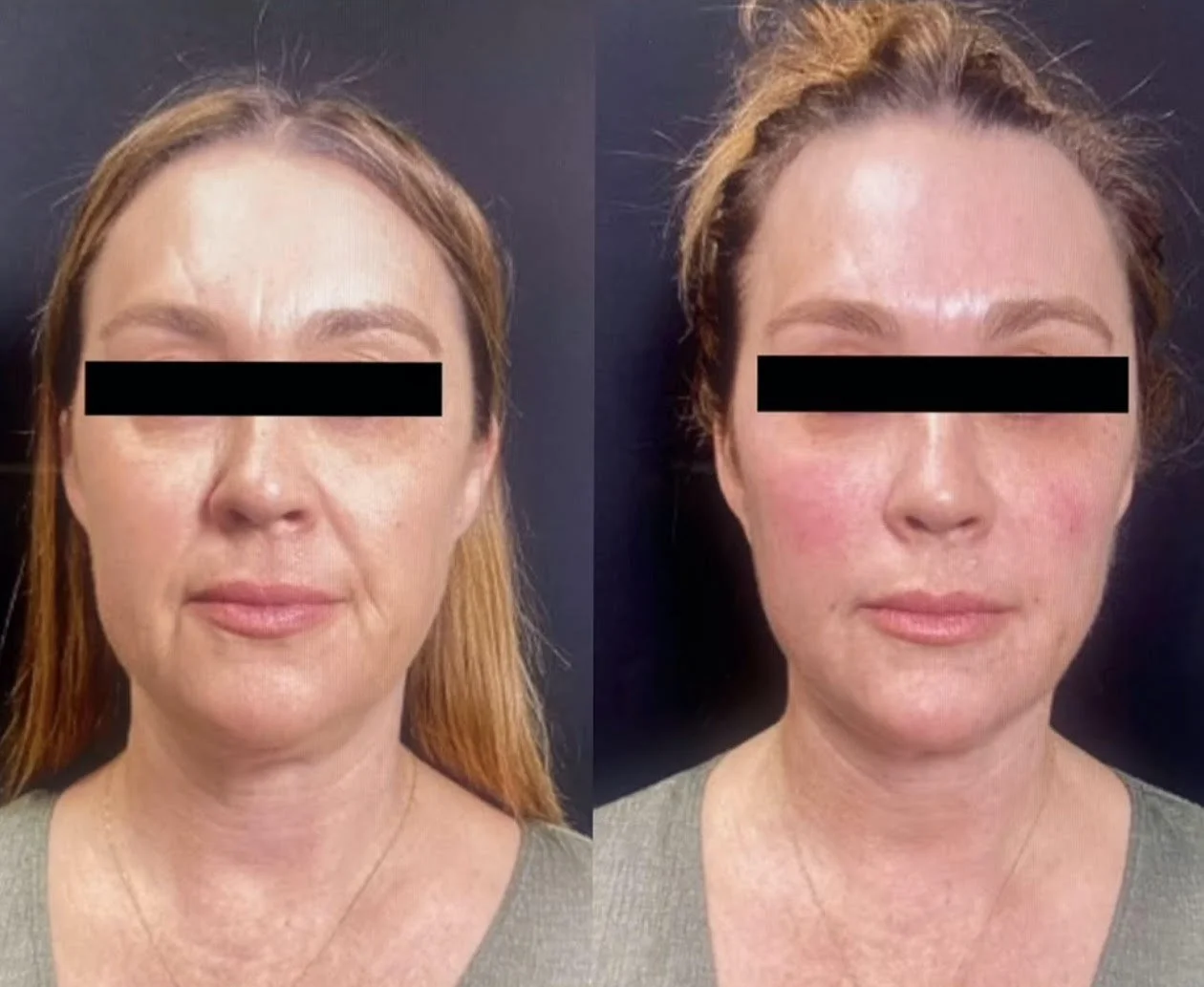 Before / After
