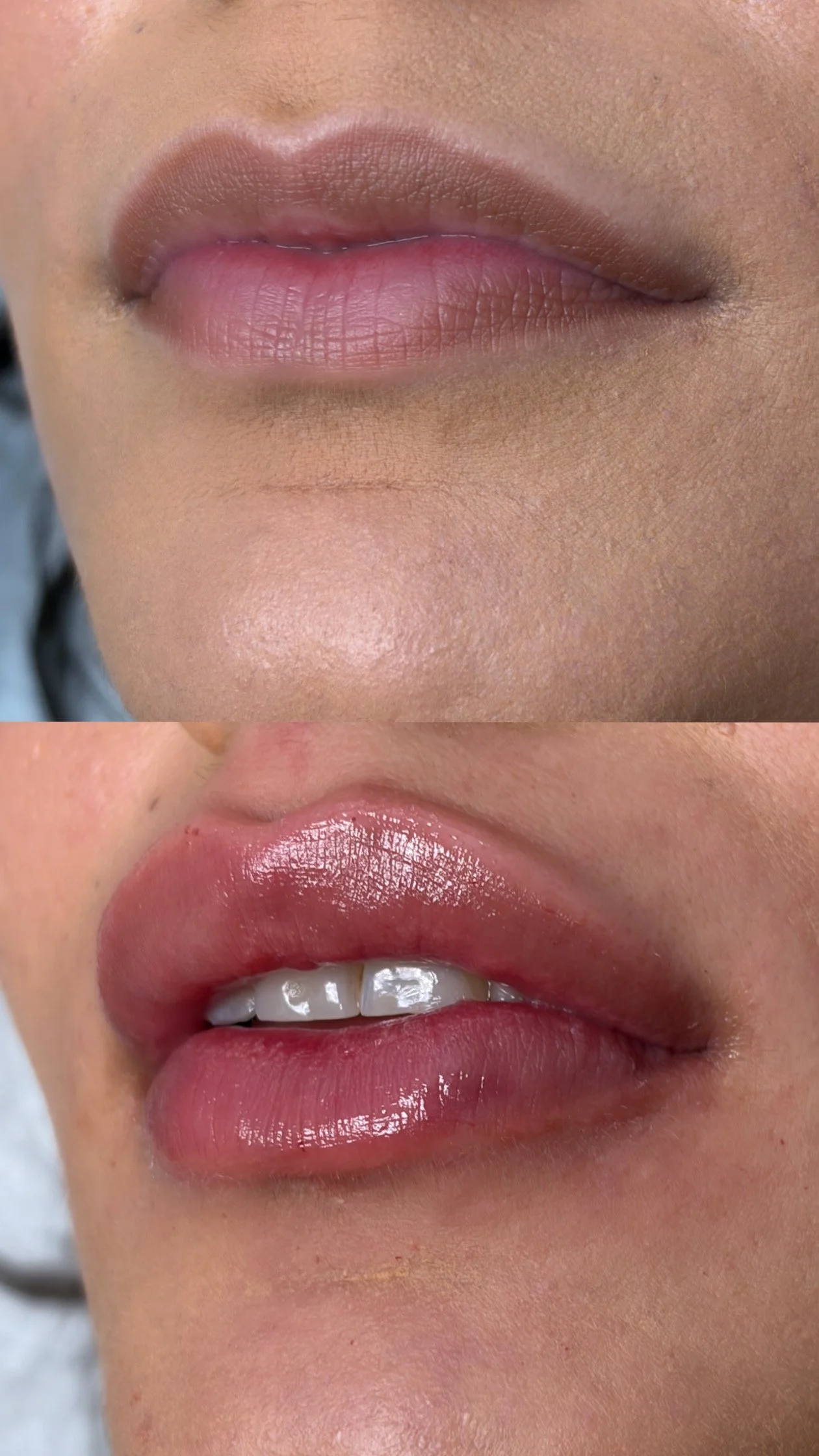 Before / After