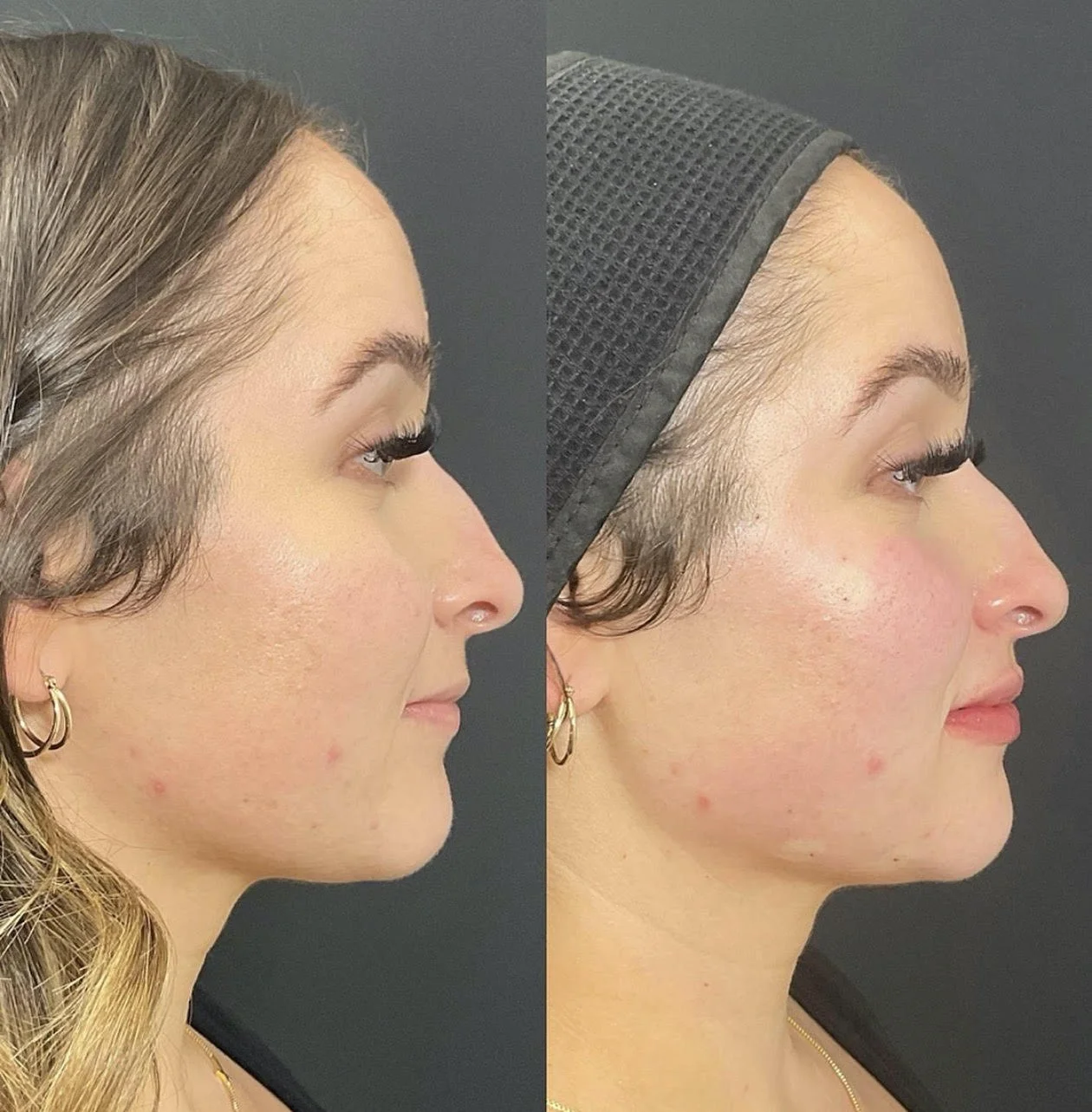 Before / After