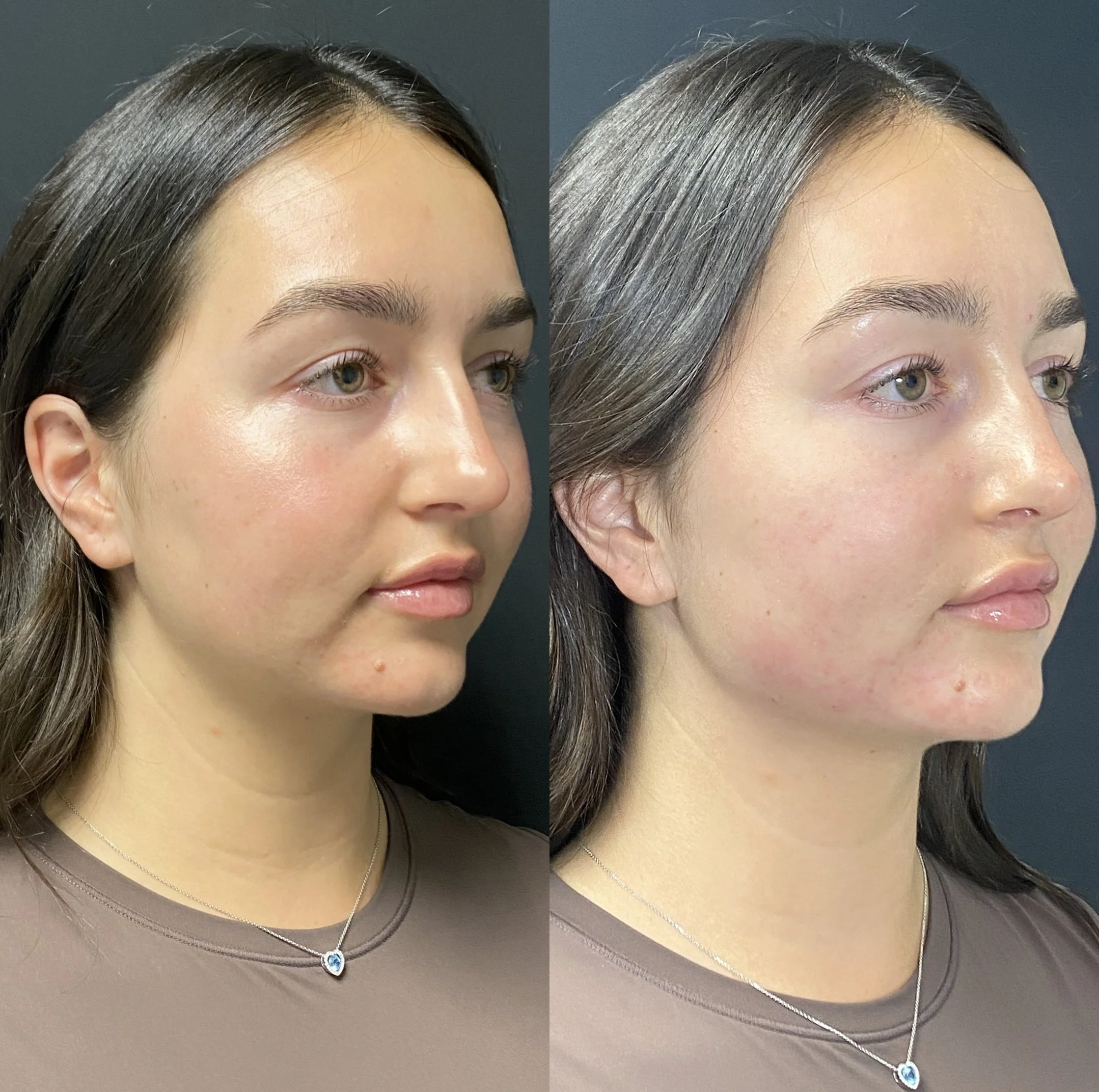 Before / After