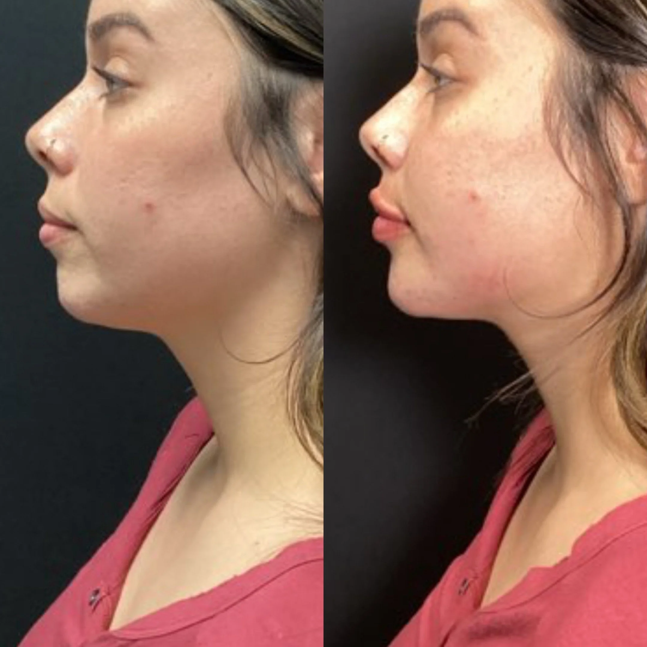 Before / After
