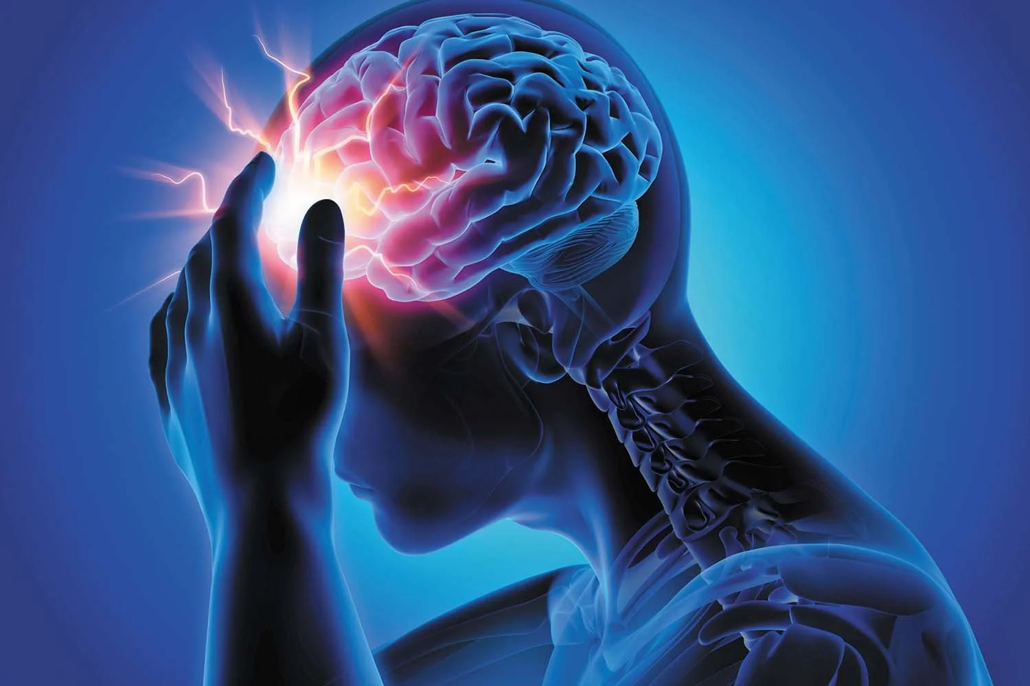 Can Physical Therapy Help Headaches and Migraines?