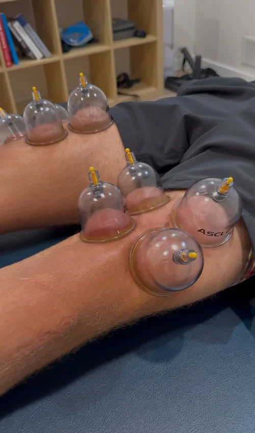 How to Prevent Injuries Before They Start