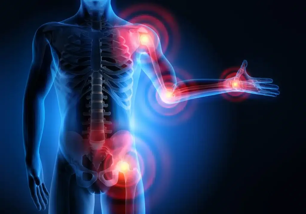 How Strength Training Can Help Prevent Arthritis