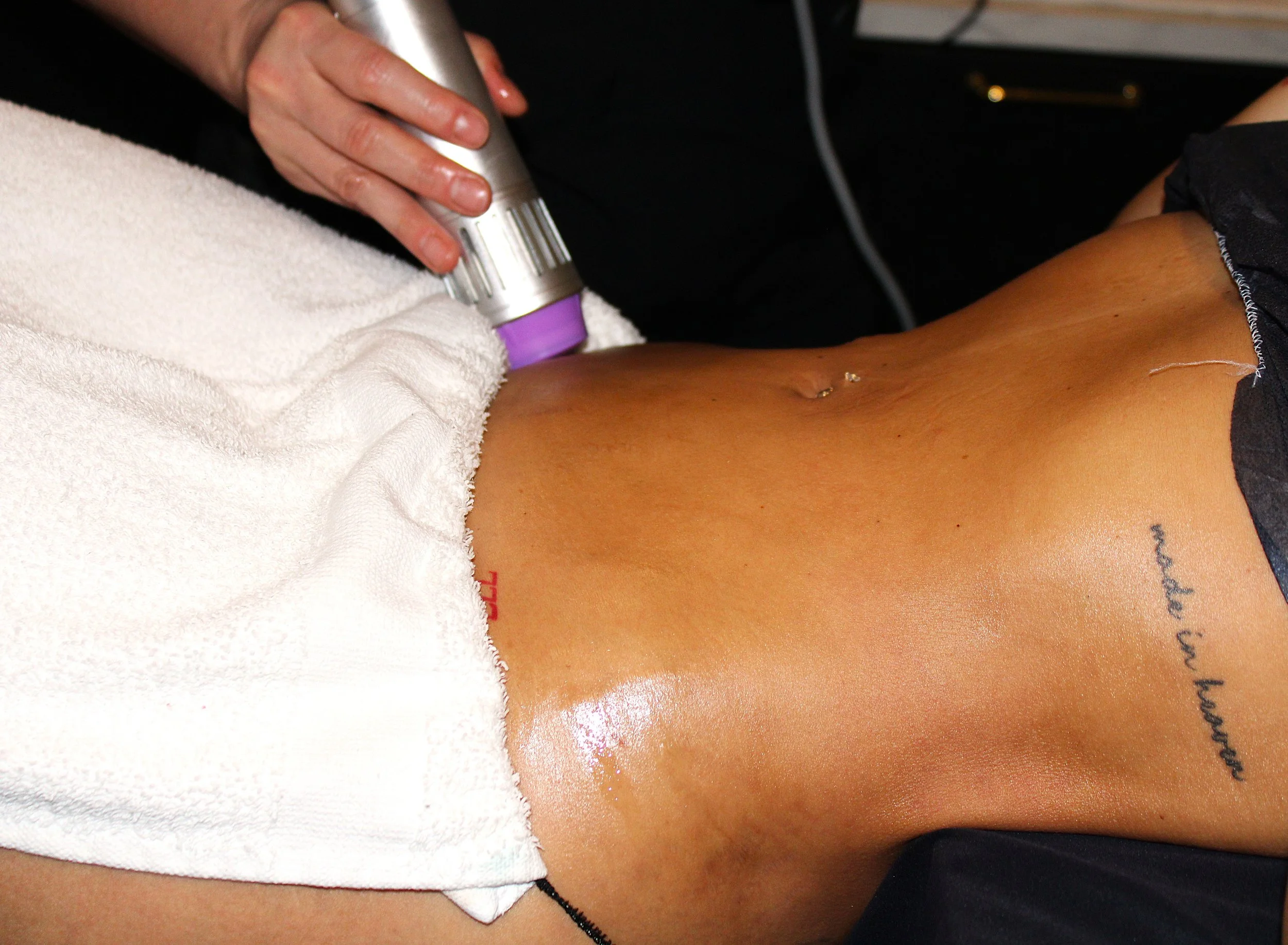 Shockwave Therapy 