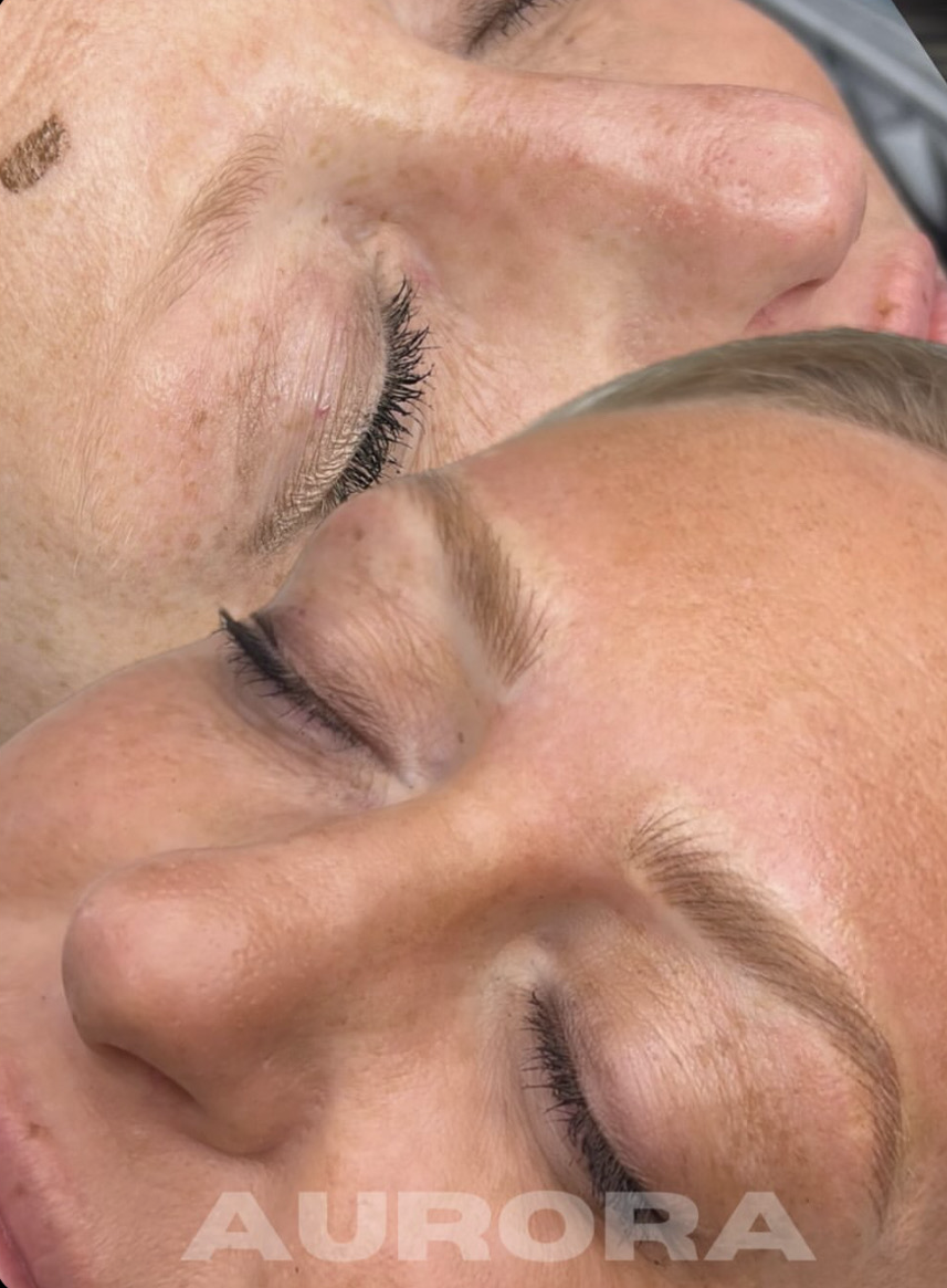 5 Signs You’re a Perfect Candidate for Nano Brows