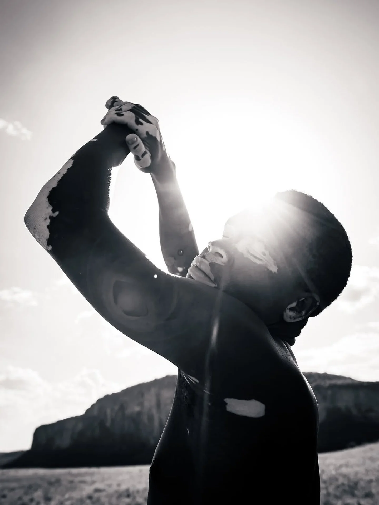 Our muse @kenyan.vitiligo.finest raising awareness for vitiligo.

&ldquo;In the warmth of light, I meet my shadow.&rdquo; @photovogue 

Photo : @chiarapiolottoph 

#PhotoVogue #FineArtPhotography #EditorialPortrait #ShadowPlay #LightAndShadow #Visual