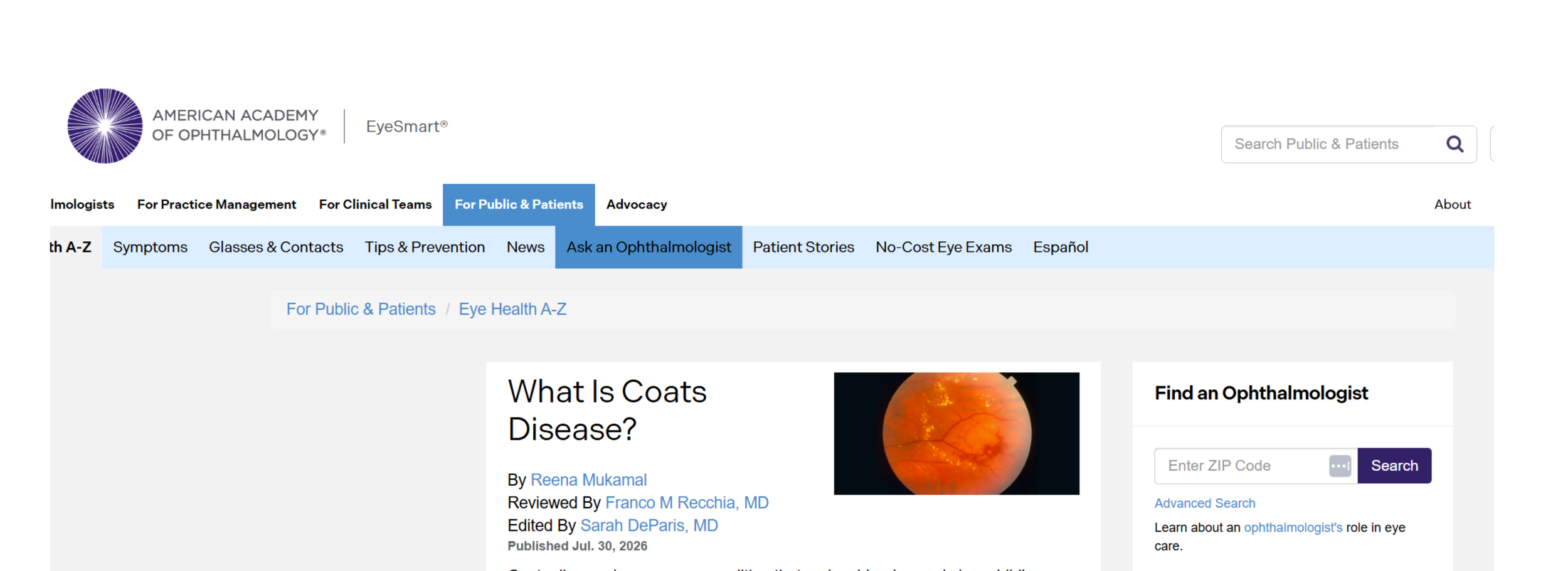 What is Coats’ Disease? A Feature in EyeNet Magazine
