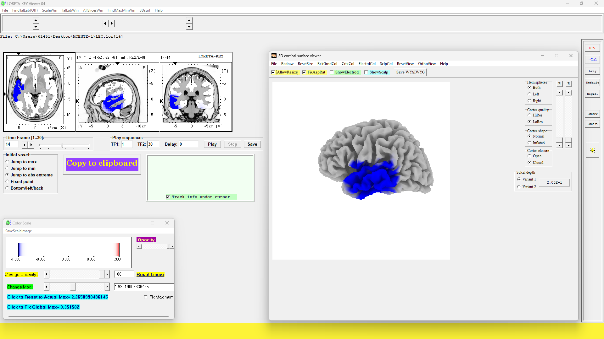 ADHD, Depression, Mood Disorders & Language or Learning Difficulties.png
