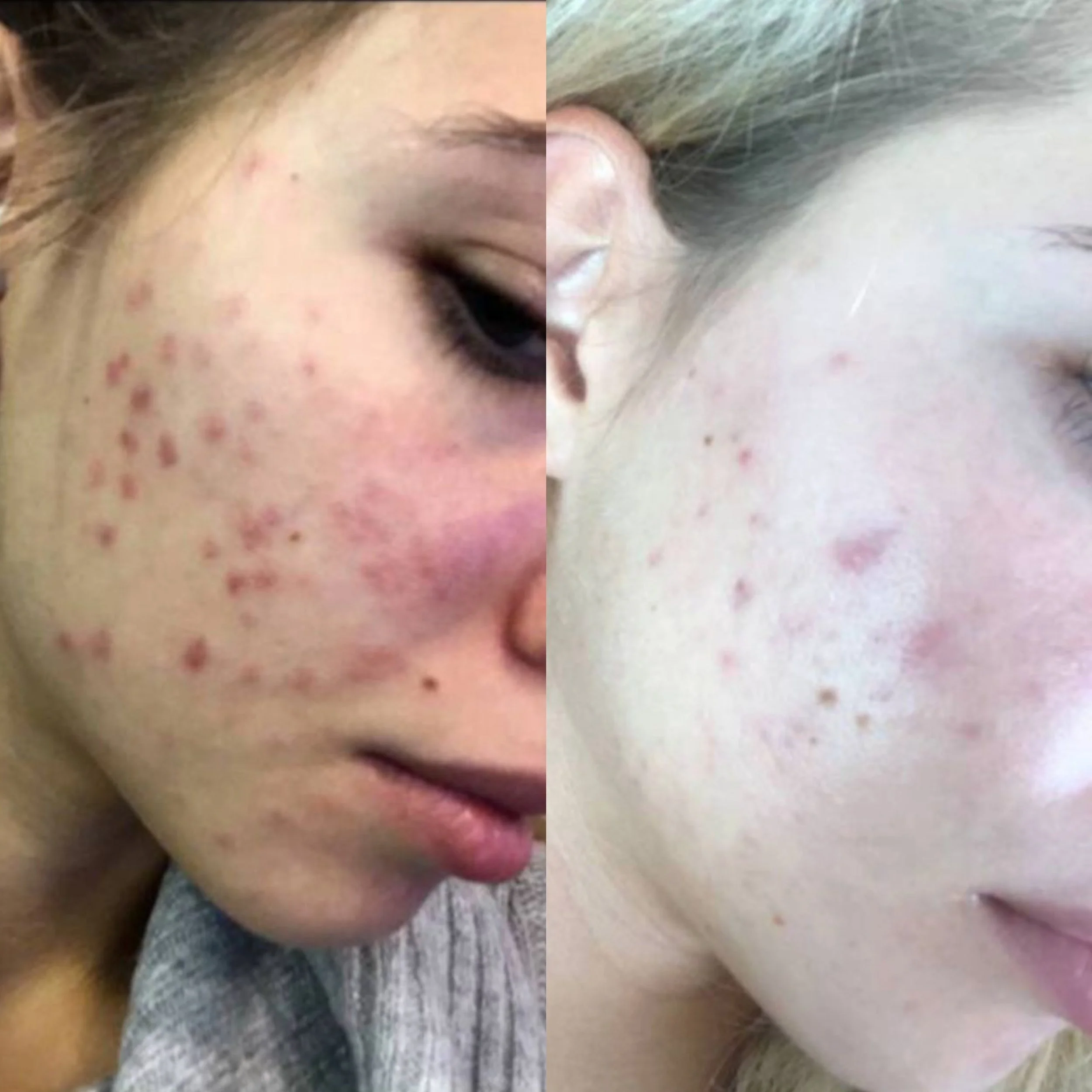 Deep cleansing facial in central London