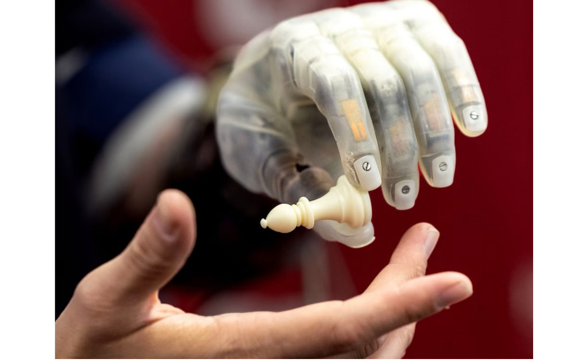 This bionic arm sounds like science fiction — but it’s not