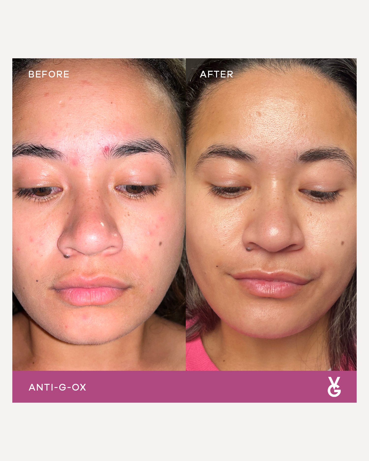 3_VidaGlow_Before+After-Anti-G-Ox_Webres.jpg