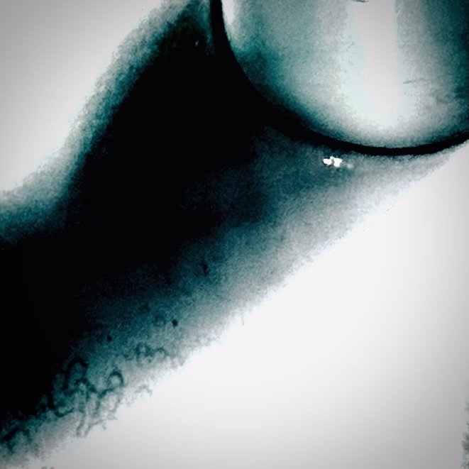 Rock/Review Chiimis - Mend