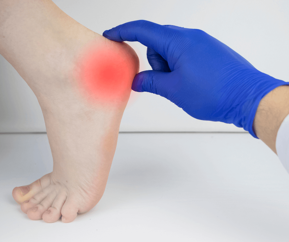 PLANTAR FASCIITIS AFFECTS PROS AND WEEKEND WARRIORS ALIKE — New York