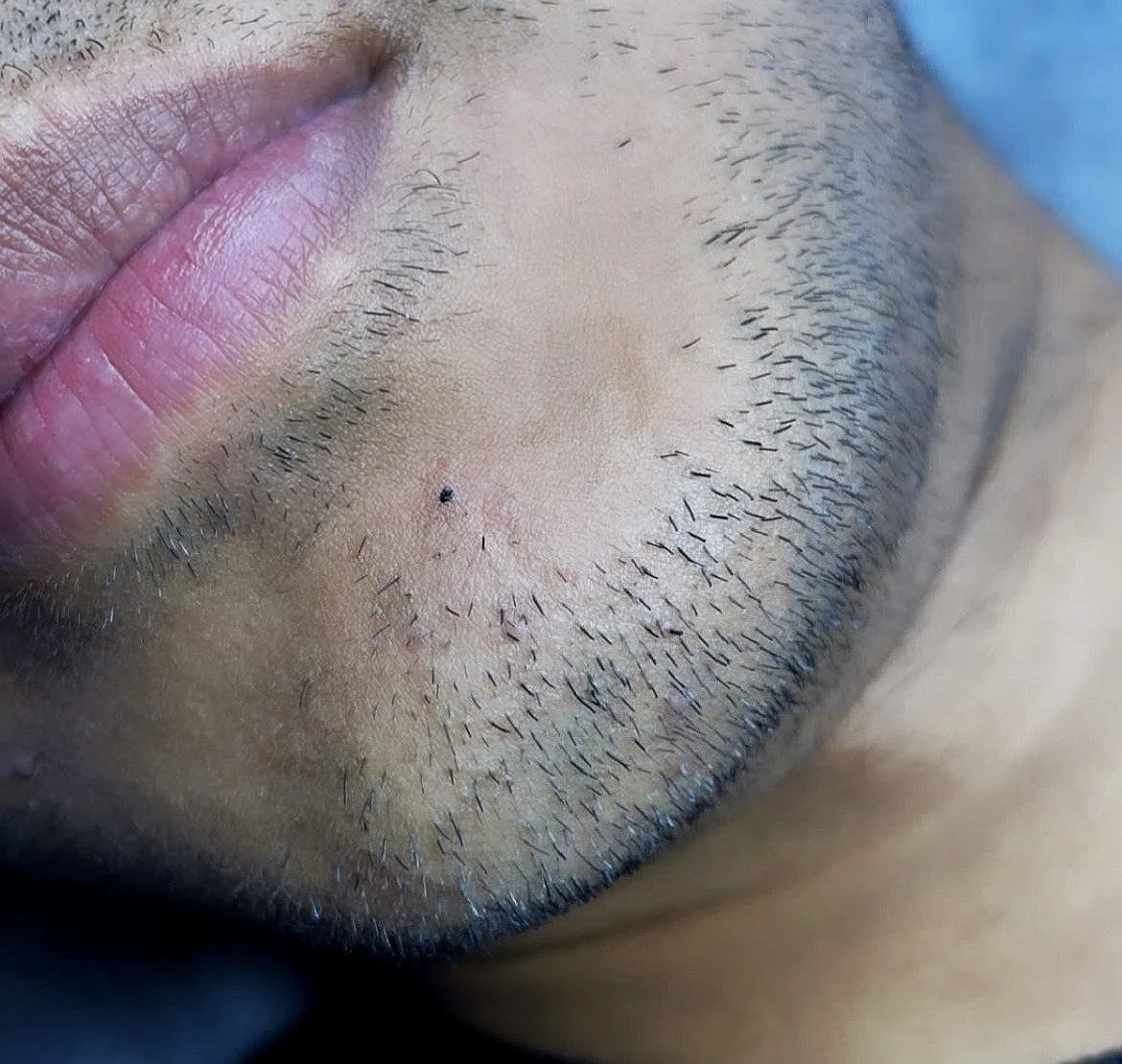 Beauty Spot.jpg