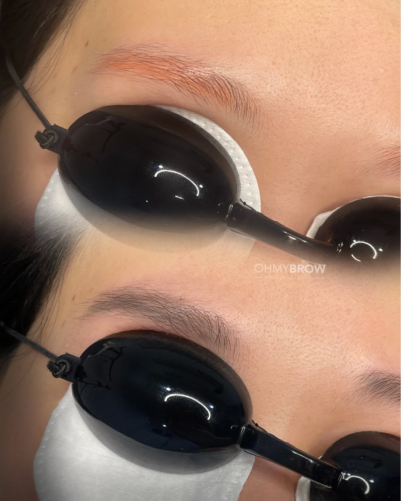 omu-removal-course-4.jpg