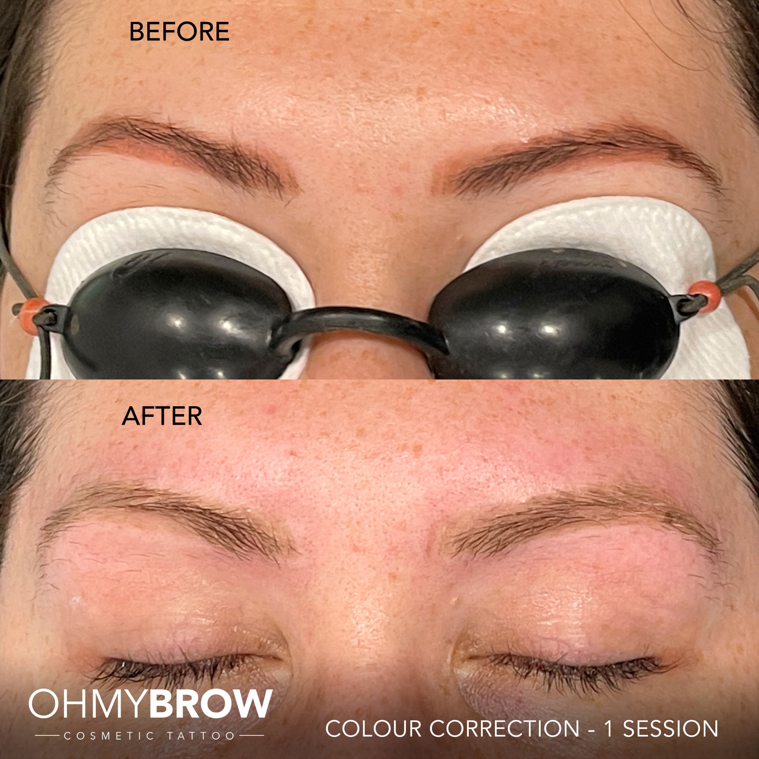 Eyebrows — Effortless Permanent Makeup by Judy Liang