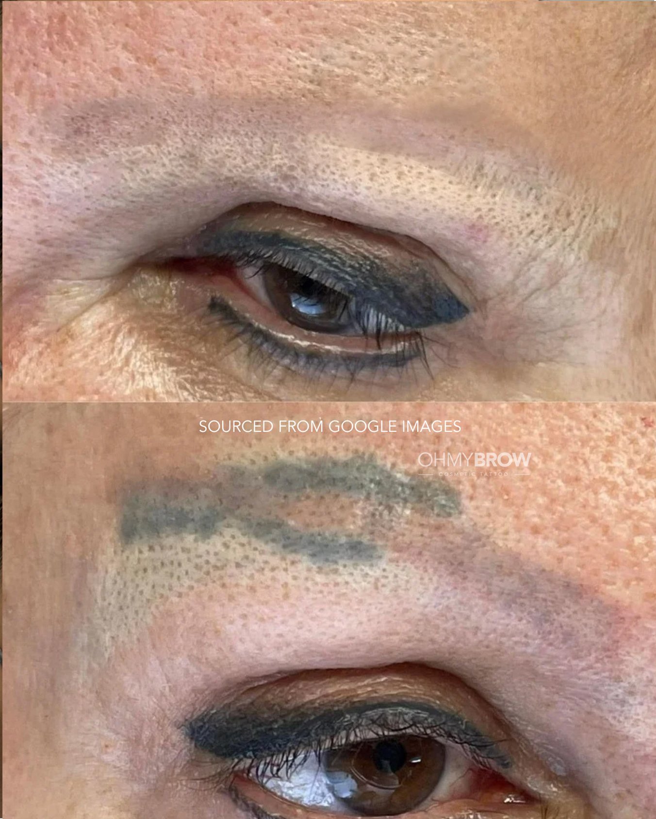 pmu-removal-course-8.jpg