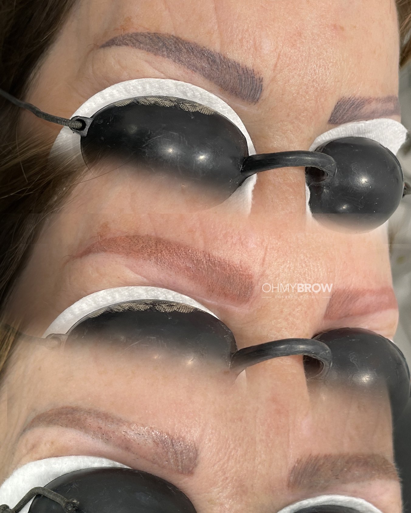 pmu-removal-course-6.jpg