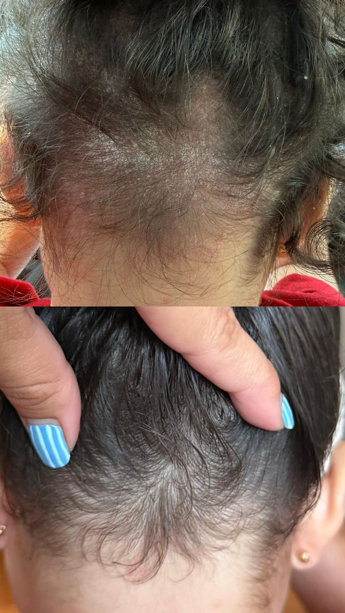 Imagen-cabello.JPG