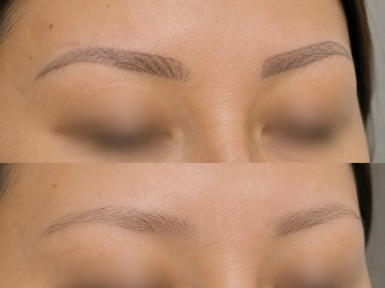 Eyebrow & Cosmetic Tattoo Removal Results-


Remove outdated microblading, powder brows, lip blush, and cosmetic eyeliner with PicoSure laser technology.